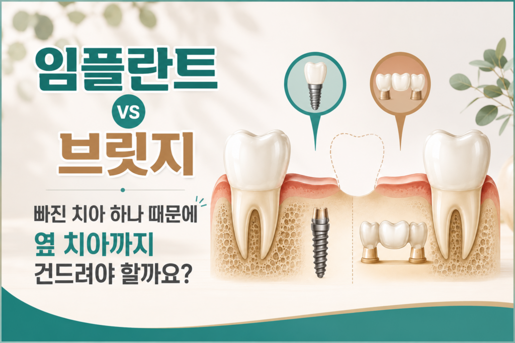 임플란트vs브릿지 썸네일