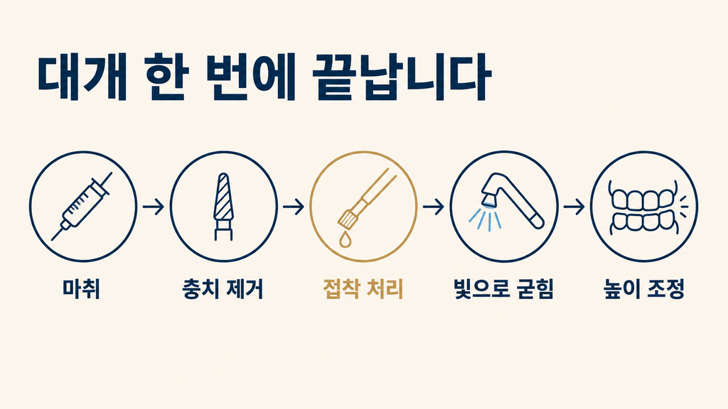 마취부터 충치 제거, 접착 처리, 레진 충전, 높이 조정까지 충치 레진 치료가 진행되는 다섯 단계 도식